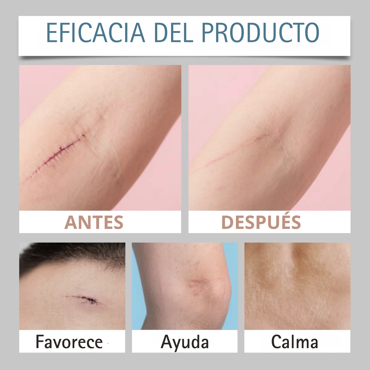 Silicona para cicatrices